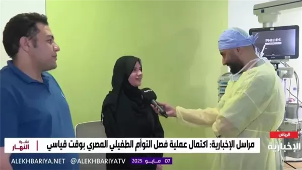 نجاح فصل توأم طفيلي مصري بالرياض