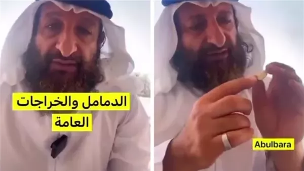 علاج الدمامل والثوم والحجامة مجربة وفعالة